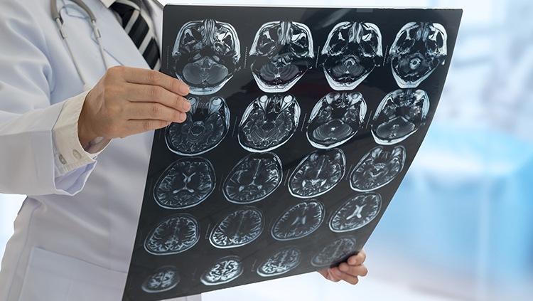 неврологические проблемы у пожилых